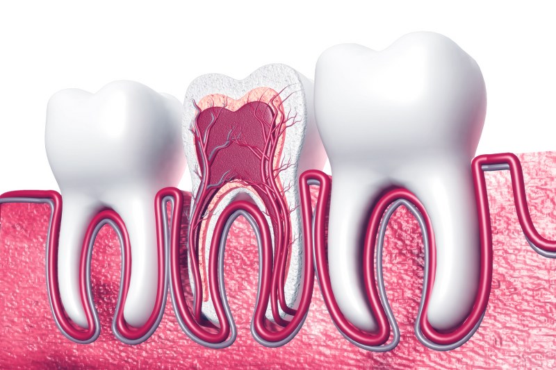 root canal