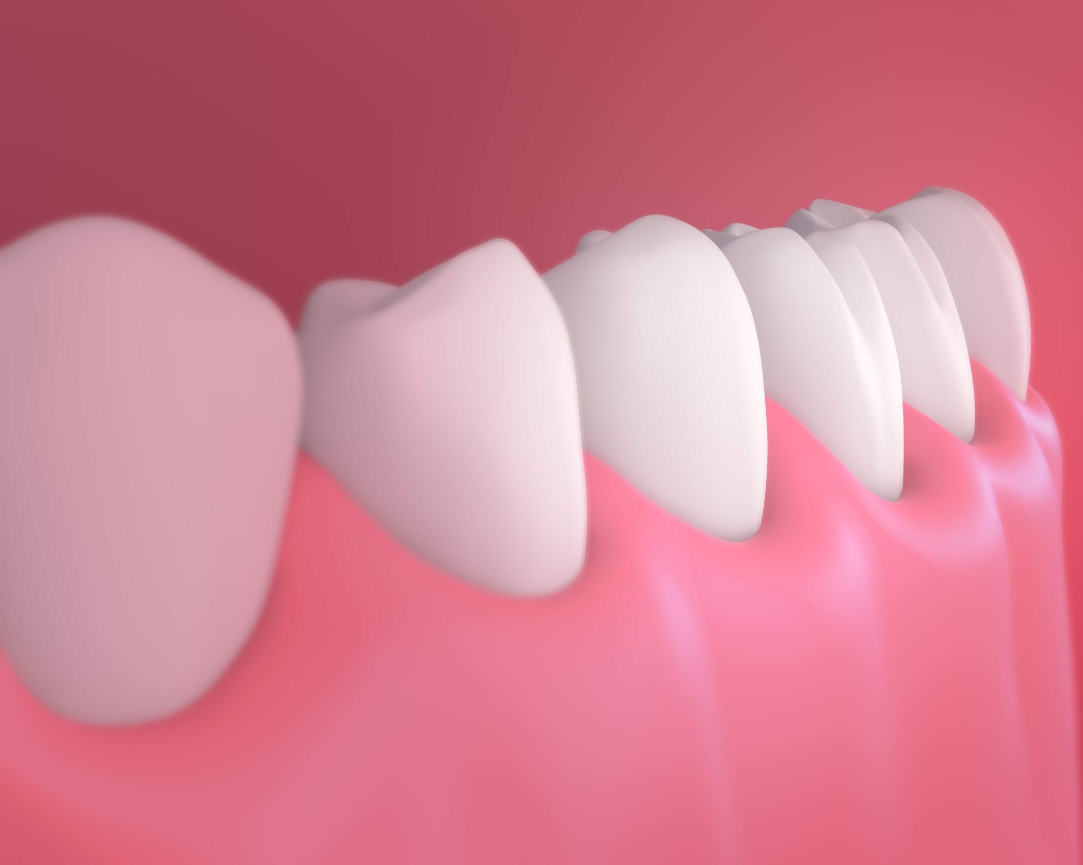 periodontics